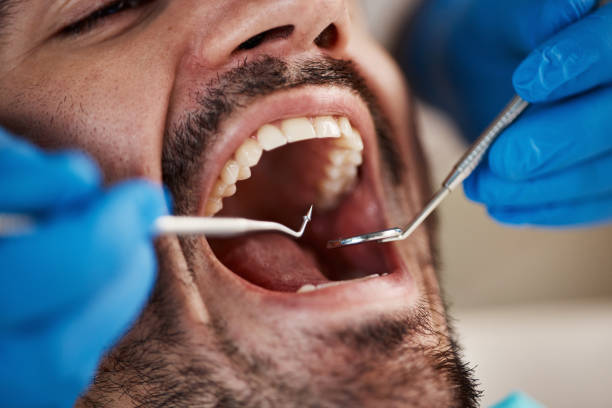 Best Tooth Infection Emergency Dentist  in Mulberry, NC