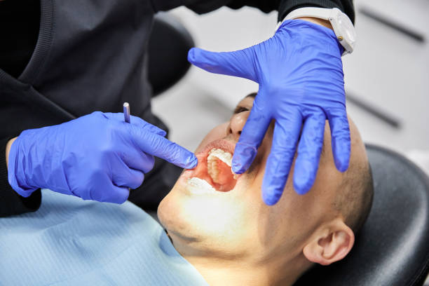 Best Dentist for Severe Toothache  in Mulberry, NC