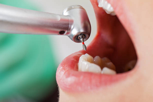 Best Knocked-Out Tooth Emergency  in Mulberry, NC